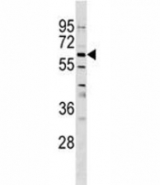 GPNMB antibody western blot analysis in CEM lysate.