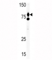 HGF antibody used in western blot to detect HGF in Ramos lysate. Predicted molecular weight: 76-91 kDa (precursor), 54-64 kDa (alpha chain), 31-34 kDa (beta chain).