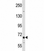 DR6 antibody western blot analysis in A549 lysate.
