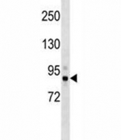 Tbk1 antibody western blot analysis in mouse cerebellum tissue lysate. Predicted molecular weight: ~84 kDa.