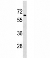 Tgfbr2 antibody western blot analysis in mouse spleen tissue lysate. Expected molecular weight ~65 kDa, routinely observed at 65-80 kDa.