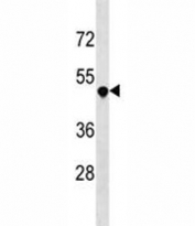 DR3 antibody western blot analysis in 293 lysate. Predicted molecular weight: 45 kDa, observed at 50-70 kDa.
