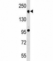 TET2 antibody western blot analysis in A549 lysate.