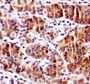 RBPJ antibody immunohistochemistry analysis in formalin fixed and paraffin embedded human stomach tissue.