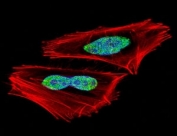 Fluorescent confocal image of A2058 cell stained with RBPJ antibody. Alexa Fluor 488 conjugated secondary (green) was used. RBPJ immunoreactivity is localized to the nucleus.