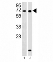 Western blot testing of RBPJ antibody at 1:2000 dilution and 1) Ramos, 2) human pancreas lysate; Predicted molecular weight ~ 56 kDa.