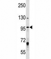 MCM8 antibody western blot analysis in T47D lysate. Expected/observed molecular weight ~94/89 kDa (isoforms 1/2).