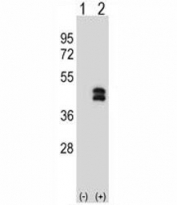 Western blot analysis of DUSP6 antibody and 293 cell lysate either nontransfected (Lane 1) or transiently transfected (2) with the DUSP6 gene.