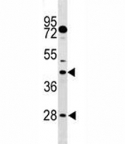 DUSP6 antibody western blot analysis in mouse stomach tissue lysate. Predicted molecular weight 42/26 kDa (isoform 1/2).