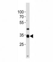 NKX3.2 antibody western blot analysis in U266 lysate.