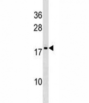 DR1 antibody western blot analysis in K562 lysate. Predicted molecular weight ~19 kDa.