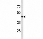 CD40 antibody western blot analysis in 293 lysate. Predicted molecular weight is 30-45 kDa depending on glycosylation level