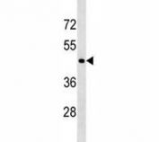 CD40 antibody western blot analysis in 293 lysate. Predicted molecular weight is 30-45 kDa depending on glycosylation level