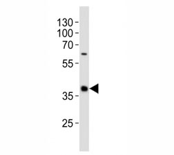Western blot analysis of lysate from human spleen tissue lysate using CD40 antibody diluted at 1:1000. Predicted molecular weight is 30-45 kDa~