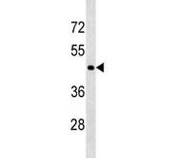 CD40 antibody western blot analysis in 293 lysate. Predicted molecular weight is 30-45 kDa