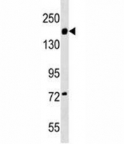 Integrin alpha 2 antibody western blot analysis in WiDr lysate.