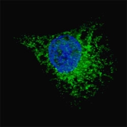 Fluorescent image of Chloroquine treated U251 cells (50 uM, 16h) stained with LC3A antibody. LC3A immunoreactivity is localized to autophagic vacuoles.~