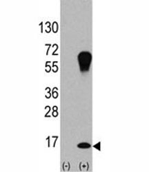 Western blot analysis of LC3A antibody and 293 cell lysate (2 ug/lane) either nont