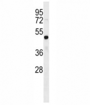 FEZF2 antibody western blot analysis in HL-60 lysate. Predicted molecular weight ~ 49 kDa.
