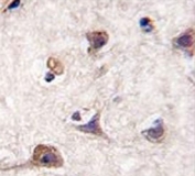 IHC analysis of FFPE human brain tissue stained with LC3 antibody