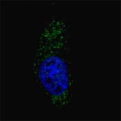 Fluorescent image of Chloroquine treated U251 cells (50 uM, 16h) stained with LC3 antibody. LC3 immunoreactivity is localized to autophagic vacuoles.