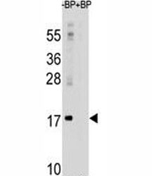LC3 antibody western blot analysis in mouse brain tissue lysate