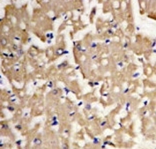 IHC analysis of FFPE heart tissue stained with LC3A antibody.