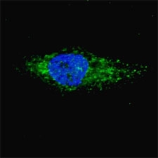 Fluorescent image of Chloroquine treated U251 cells (50 uM, 16h) stained with LC3A antibody. Immunoreactivity is localized to autophagic vacuoles in the cytoplasm of U251 cells.