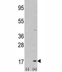 Western blot analysis of LC3A antibody and 293 cell lysate (2 ug/lane) either nontransfected (Lane 1) or transiently transfected with the LC3 gene (2).