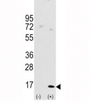 Western blot analysis of LC3A antibody and 293 cell lysate (2 ug/lane) either nontransfected (Lane 1) or transiently transfected with the LC3 /APG8a gene (2).