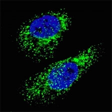 Fluorescent image of Chloroquine treated U251 cells (50 uM, 16h) stained with LC3A antibody. Immunoreactivity is localized to autophagic vacuoles in the cytoplasm of U251 cells.~