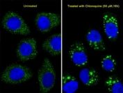 Immunofluorescent analysis of U251 cells using LC3B antibody. U251 cells(right) were treated with Chloroquine (50 uM,16h). Ab was diluted at 1:25 dilution. Alexa Fluor 488-conjugated goat anti-rabbit lgG was used as the secondary Ab (green). DAPI was used as a nuclear counterstain (blue).