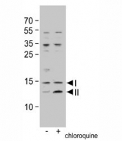 Western blot analysis of LC3B antibody in untreated or treated HeLa cell lysate; Both non-lipidated (arrow, I) and lipidated LC3B (arrow, II) were detected.