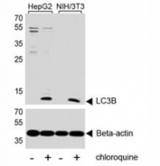 Western blot analysis of lysate from human HepG2 and mouse NIH3T3 cell line, untreated or treated with chloroquine (50uM) using LC3B antibody at 1:1000.
