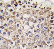 IHC analysis of FFPE human testis tissue stained with LC3B antibody.