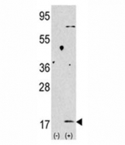 Western blot analysis of LC3B antibody and 293 lysate transiently transfected with the MAP1LC3B gene (2ug/lane).