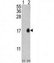 Western blot analysis of MAP1LC3B antibody and 293 cell lysate (2 ug/lane) either nontransfected (Lane 1) or transiently transfected with the MAP1LC3B gene (2).