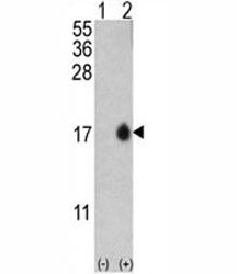 Western blot analysis of MAP1LC3B antibody and 293 cell lysate (2 ug/lane) either nontransfected (Lane 1) or transiently transfected with the MAP1