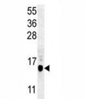 LC3B antibody western blot analysis in mouse cerebellum tissue lysate