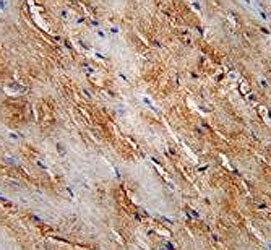 LC3B antibody immunohistochemistry analysis in formalin fixed and paraffin embedded human skeletal muscle.