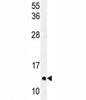 Western blot analysis of LC3C antibody and HeLa lysate