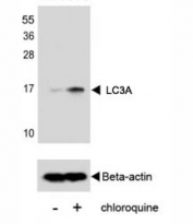Western blot analysis of mouse NIH3T3 cells, untreated or treated with chloroquine (100ng/ml) tested with Cleaved LC3A antibody or beta-Actin Ab.
