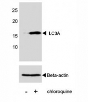 Western blot analysis of human A431 cells, untreated or treated with chloroquine (100ng/ml) tested with Cleaved LC3A antibody or beta-Actin Ab.
