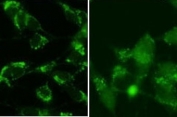 SY5Y cells were pretreated with 5nM bafilomycin for 24hr and fixed in methanol (left panel) or 4% of paraformaldehyde (right panel). Testing with LC3B antibody at dilution 1:100. Data courtesy of Jianhui Zhu, MD, PhD & Charleen T. Chu, MD, PhD, University of Pittsburgh School of Medicine.