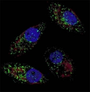 Fluorescent image of U251 cells stained with LC3B antibody at 1:100. Immunoreactivity is localized to autophagic vacuoles in the cytoplasm.