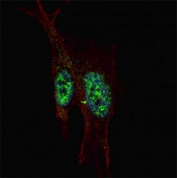 Fluorescent confocal image of SY5Y cells stained with STAT-3 antibody at 1:200. Note the highly specific localization of the STAT3 mainly to the nucleus.