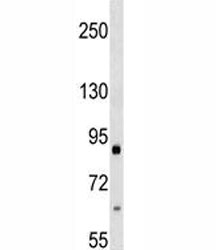 Integrin beta 2 antibody western blot analysis in 293 lysate. Predicted molecular weight ~85 kDa.