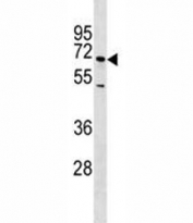 E-Selectin antibody western blot analysis in NCI-H460 lysate. Predicted molecular weight: 64-115 kDa depending on glycosylation level.