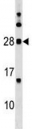 MOG antibody western blot analysis in human K562 lysate. Expected molecular weight: 15-28 kDa depending on glycosylation level.