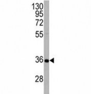 APG5 antibody western blot analysis in HeLa lysate. Predicted molecular weight ATG5: ~32 kDa; ATG5/ATG12 heterodimer: ~56 kDa.